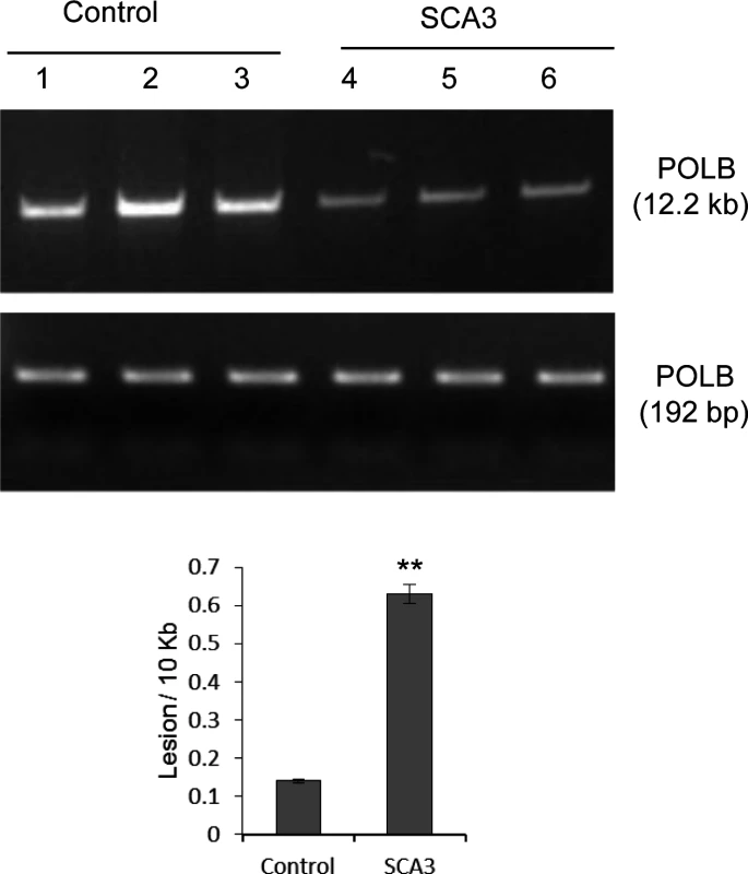 LA-QPCR shows increased genomic DNA damage levels in SCA3 patients’ brain tissue.