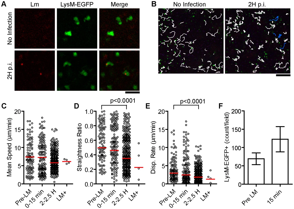 A small fraction of patrolling neutrophils take up <i>Lm</i>.