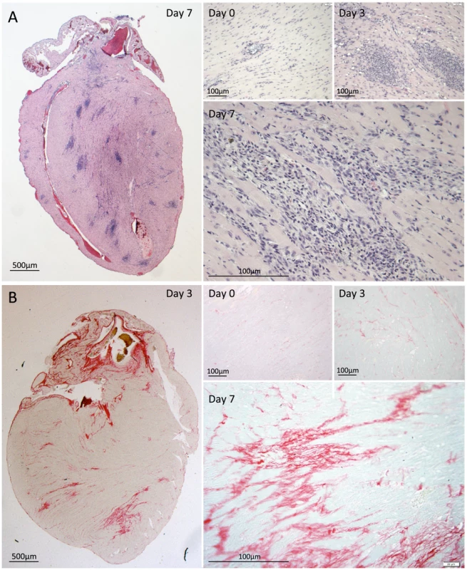 Immune cell infiltration and collagen deposition following antimicrobial therapy.