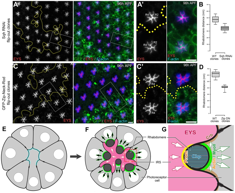 Actomyosin contraction is required for increasing the width of the retinal lumen.