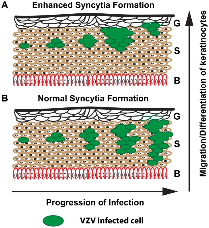 Proposed model for limited skin pathogenesis of VZV caused by exaggerated syncytia formation.