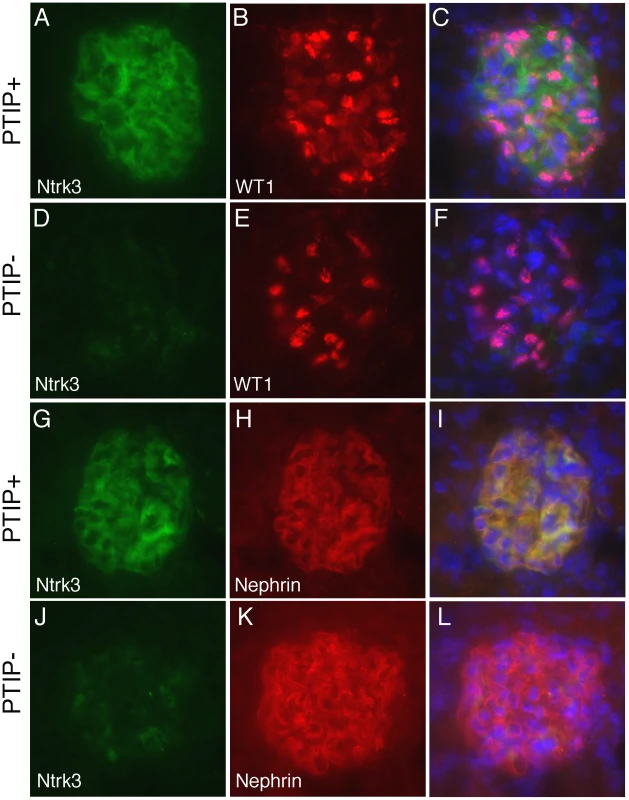 Ntrk3 in the Glomerulus.