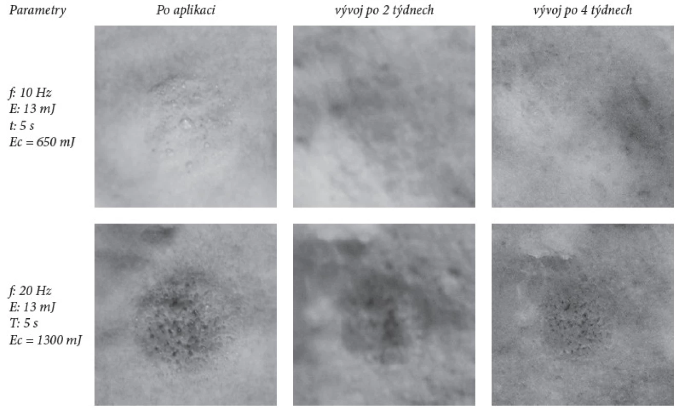 Příklad fotografií vzorků plísně ozařováných vyššími hodnotami, kdy dochází k okamžité destrukci vzorků plísně