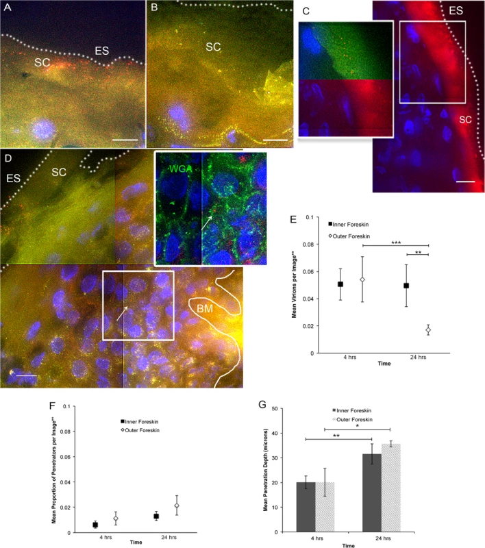<i>Ex vivo</i> PA GFP HIV-1 interactions with adult human foreskin tissues.