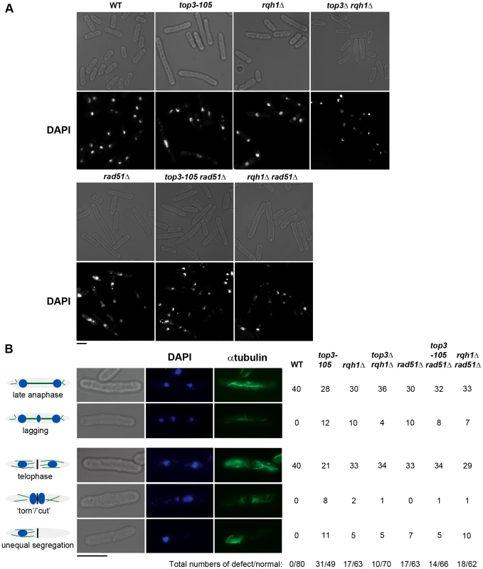 Top3 and Rqh1 are required for chromosome segregation.