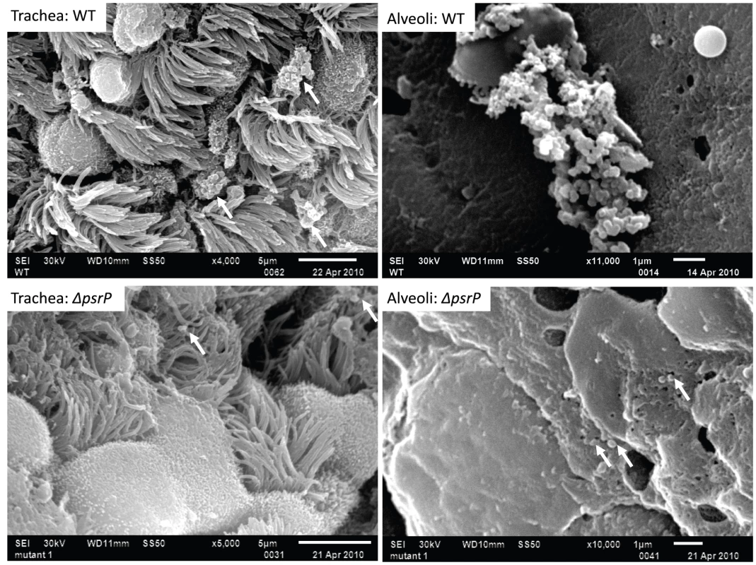 PsrP promotes the formation of bacterial aggregates <i>in vivo</i>.