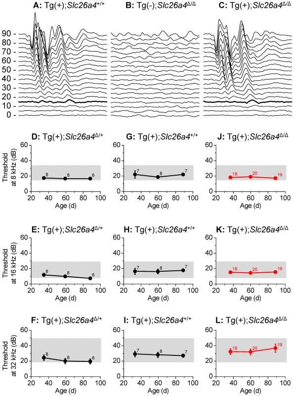 Hearing tests based on auditory brain stem responses.