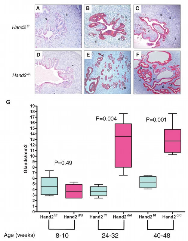 Endometrial hyperplasia in <i>Hand2</i> conditional knock-out mice as a function of age.