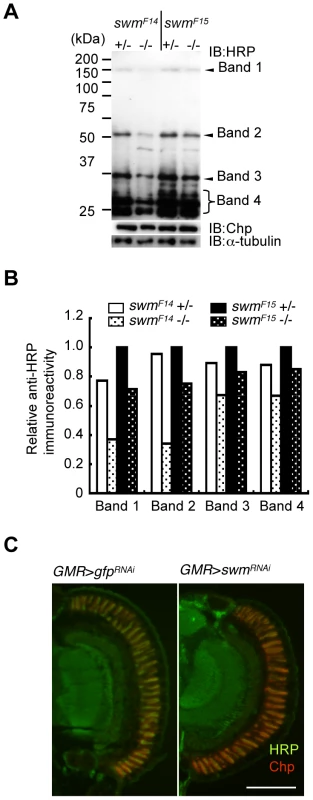 Immunoblot analysis.