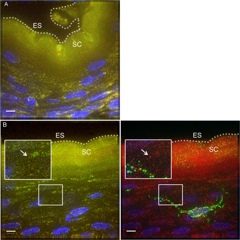 PA GFP HIV-1 interactions with rhesus macaque male penile tissues <i>in vivo</i>.