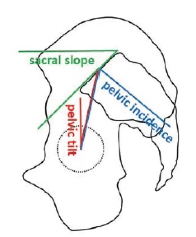 Parametry orientace a postavení pánve v sagitální rovině. 