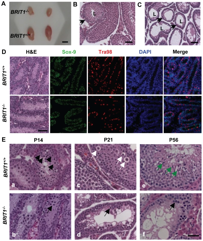 <i>BRIT1</i>-deficient male were infertile and exhibited meiotic defects.