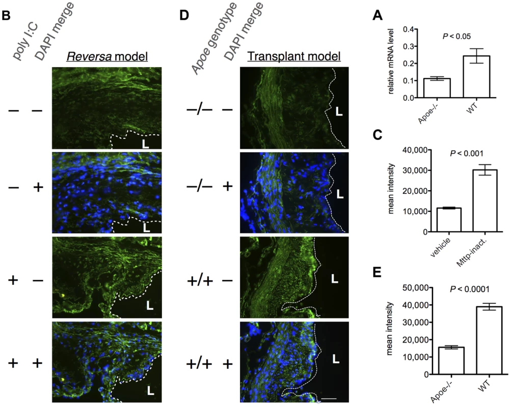 β-catenin expression is increased in regressing vs. progressing plaques, in both models of plaque regression.