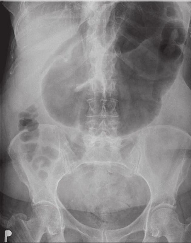 Vstupní RTG snímek
Fig. 1: Initial X-ray image