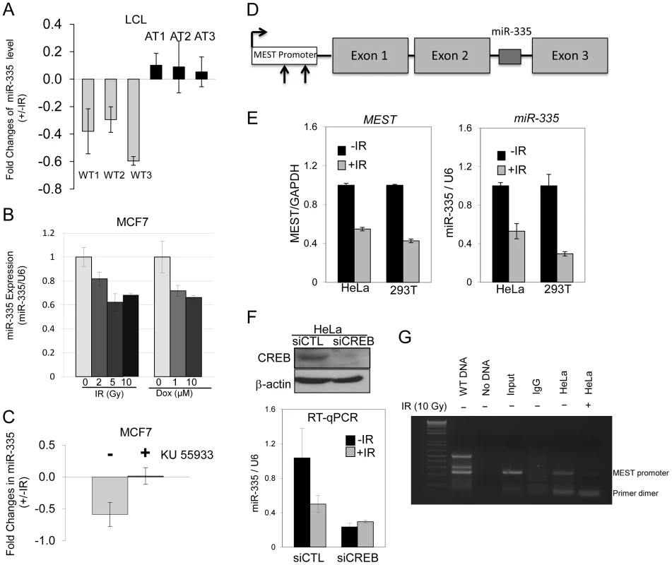 ATM–dependent downregulation of miR-335 post-IR.