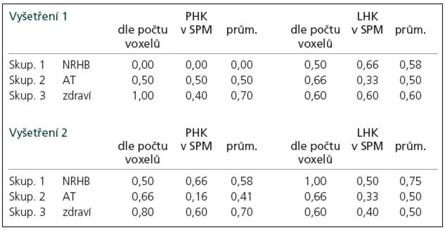 Semi-kvantitativní hodnocení platnosti formule „Pro tzv. tandemovou ruku je počet aktivovaných voxelů na dané statistické úrovni v M1 oblasti minimálně 1,5krát vyšší než pro tzv. navigační ruku.“
