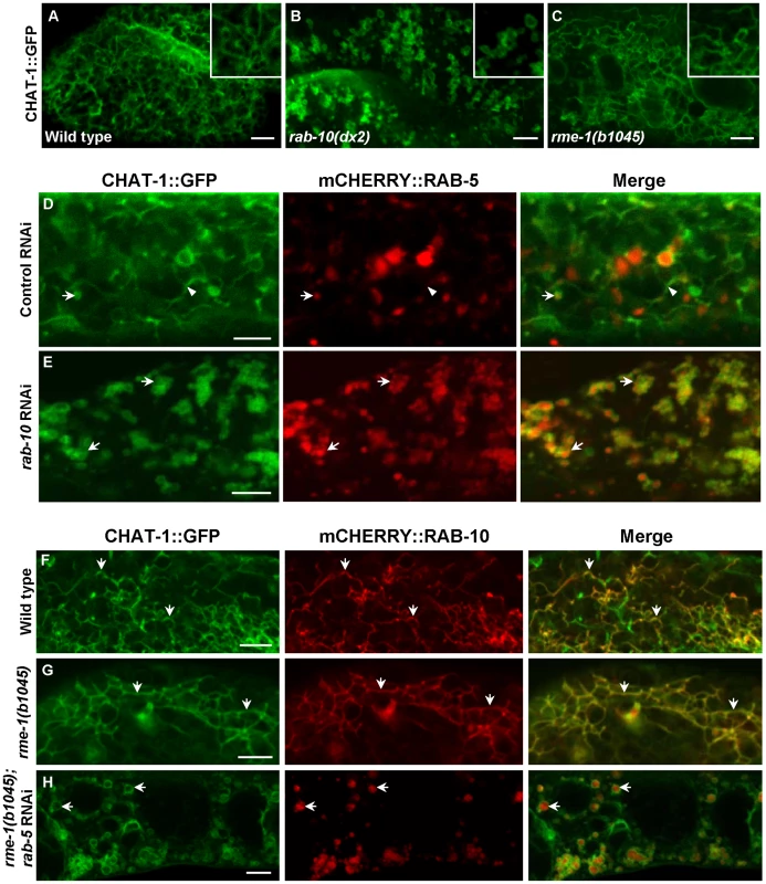 CHAT-1 tubules are disrupted in <i>rab-10(lf)</i> but are further extended in <i>rme-1(lf)</i> mutants.