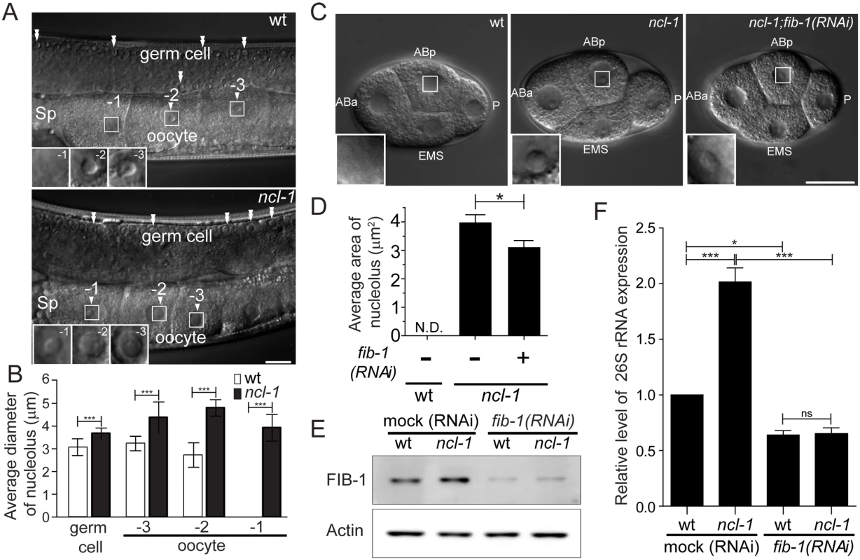 NCL-1 acting as a restriction factor for nucleolar size and rRNA expression is associated with nucleolar protein, FIB-1.