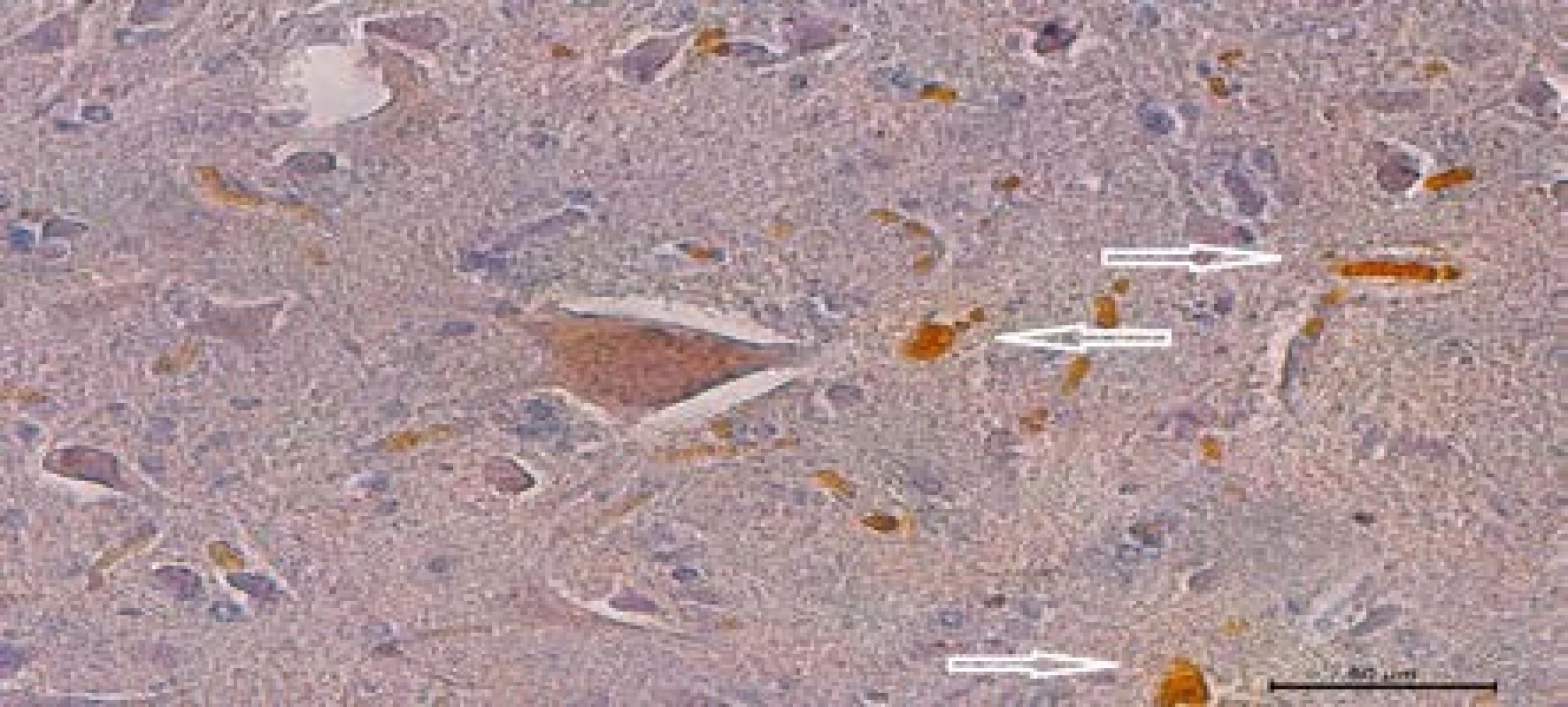 Histologická verifikace prorůstání axonů anastomózou – přítomnost křenové peroxidázy (HRP, rezavé částečky) v modifikovaném ventrálním míšním kořeni, zvětšení 50×
Fig. 9. Histological verification of axonal penetration through anastomosis. Horse-radish peroxidase (foxy particles) in modified ventral spinal root. Zoom 50×