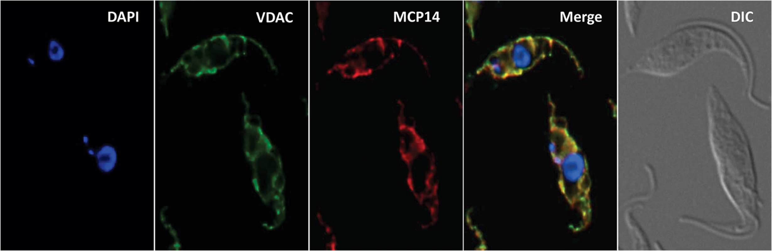 Localization of TbMCP14.