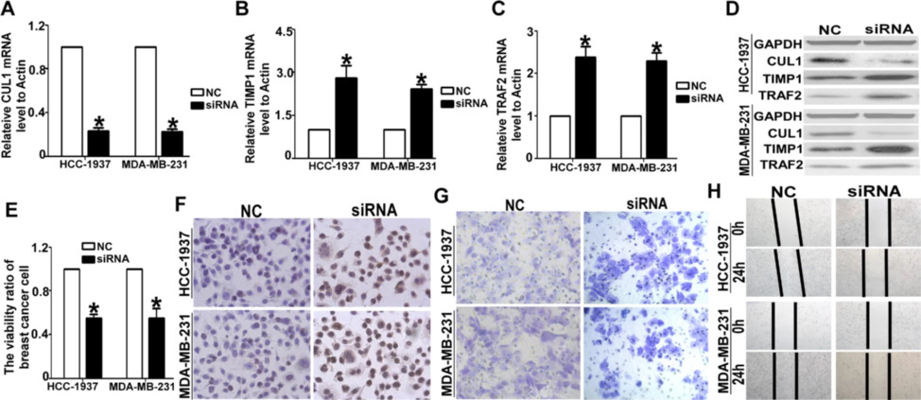 Knocked-down the CUL1 lead to the same effect of Selumetinib. a The siRNA could effective inhibited the CUL1 expression on mRNA levels (For HCC1973 cells, the CUL1 level was 0.23HCC19. For MDA-MB-231 cells, the CUL1 level was 0.22 ± 0.04.*P < 0.01 compared with the NC group, which is 1.). b After silencing the CUL1, the TIMP1 level was increased (For HCC1973 cells, the TIMP1 level was 2.81 ± 0.75. For MDA-MB-231 cells, the TIMP1 level was 2.41 ± 0.23.*P < 0.01 compared with the NC group, which is 1.). c The tendency of TRAF2 mRNA expression levels in MDA-MB-231 and HCC-1937 cells were equal to TIMP1 determined by QRT-PCR (For HCC1973 cells, the TRAF2 level was 2.38 ± 0.45. For MDA-MB-231 cells, the TRAF2 level was 2.29 ± 0.33. *P < 0.01 compared with the NC group, which is 1.). d the CUL1, TIMP1 and TRAF2 protein expression levels in HCC-1937 and MDA-MB-231 cells were examined by WB analysis. e After transfected the siRNA-CUL into HCC-1937 and MDA-MB-231 cells, the cell proliferation ratio was inhibited significantly (For HCC1973 cells, the viability ratio was 0.55 ± 0.06. For MDA-MB-231 cells, the viability ratio was 0.53 ± 0.15. *P < 0.01 compared with the NC group, which is 1.). f the Tunnel analysis clarified this negative effect of siRNA-CUL1. g The transwell analysis showed, the numbers of the migrated cells in the NC group of both two TNBC cells, are almost double that are in the siRNA-CUL1 group h. The wound-healing assay showed the cell migration ability was reduced observably in siRNA-CUL1 group. For the NC group, the gap closure rate is more than two to thirds in both HCC-1937 and MDA-MB-231 cells. For siRNA-CUL1 group, the gap closure rate is less than one thirds