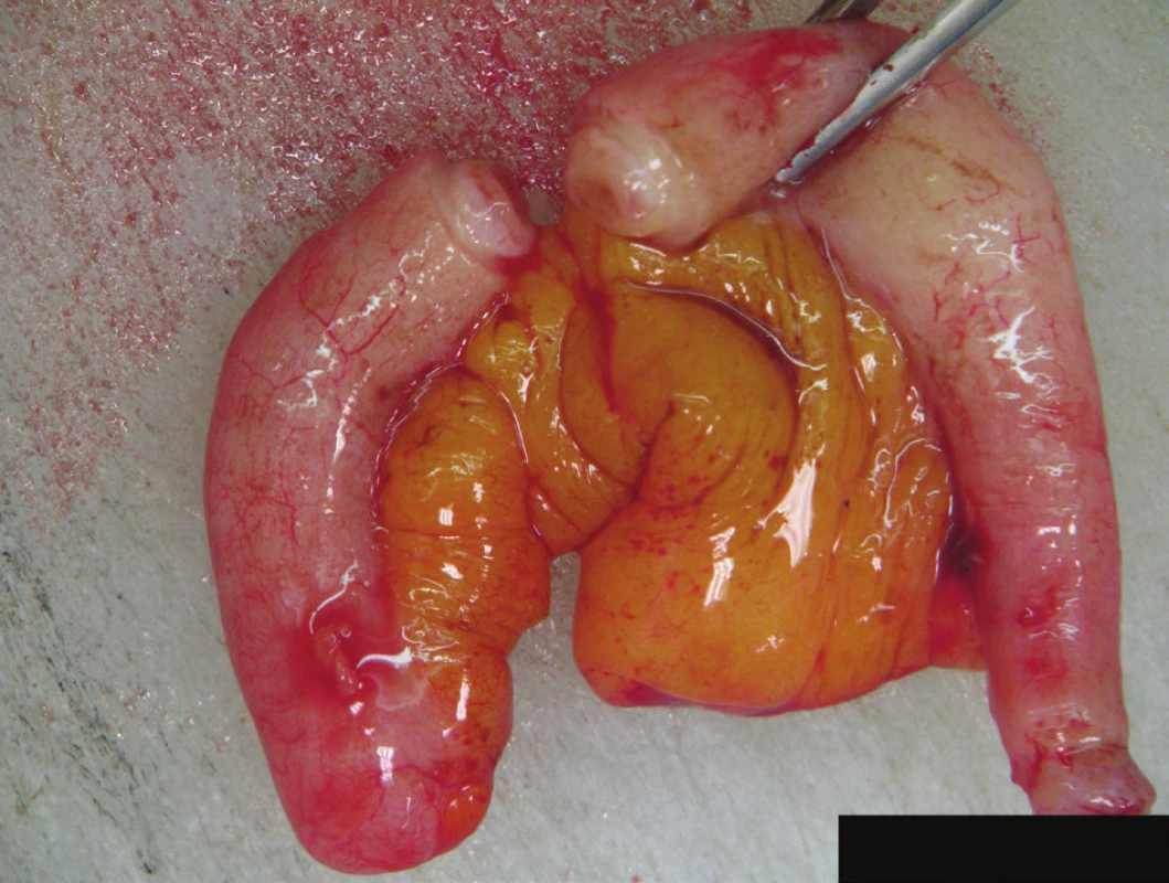 Preparát appendixu
Fig. 4: Appendix specimen