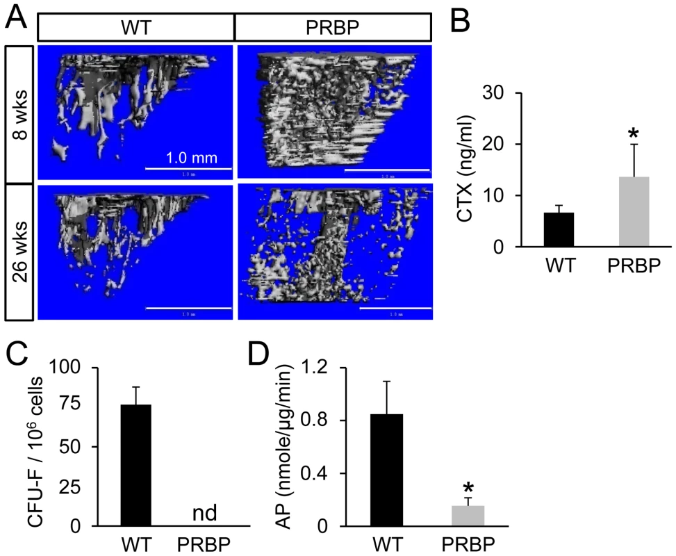 Bone loss in PRBP mice at 26 weeks of age.