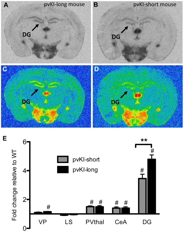 Allelic differences in the <i>Avpr1a</i> microsatellite contribute to intraspecies variation in V1aR binding.