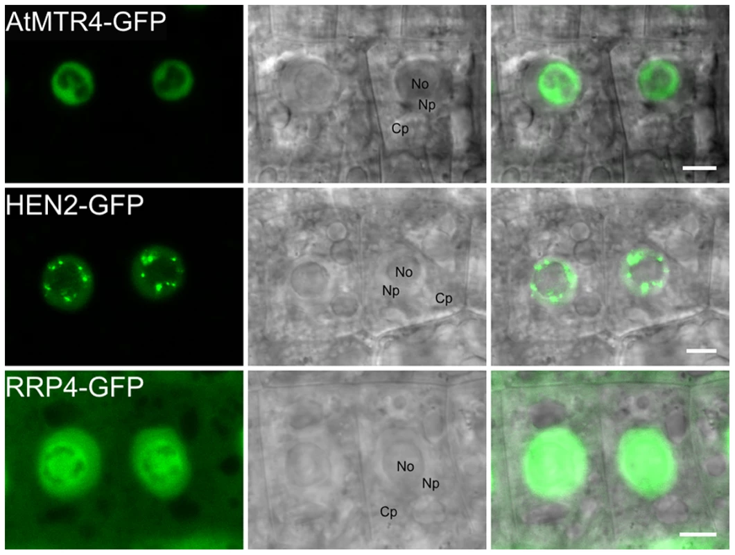 MTR4 and HEN2 have distinct localization patterns.