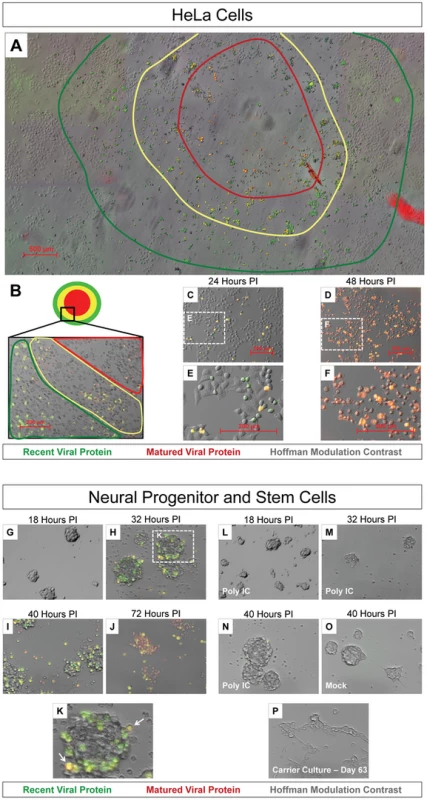 Timer-CVB3 plaque progression and viral spread in HeLa cells and NPSCs.