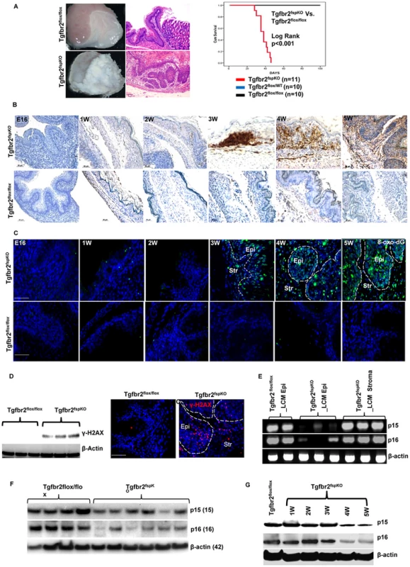 Stromal deletion of Tgfbr2 promotes inflammation-induced DNA damage and loss of <i>p15 and p16</i>.
