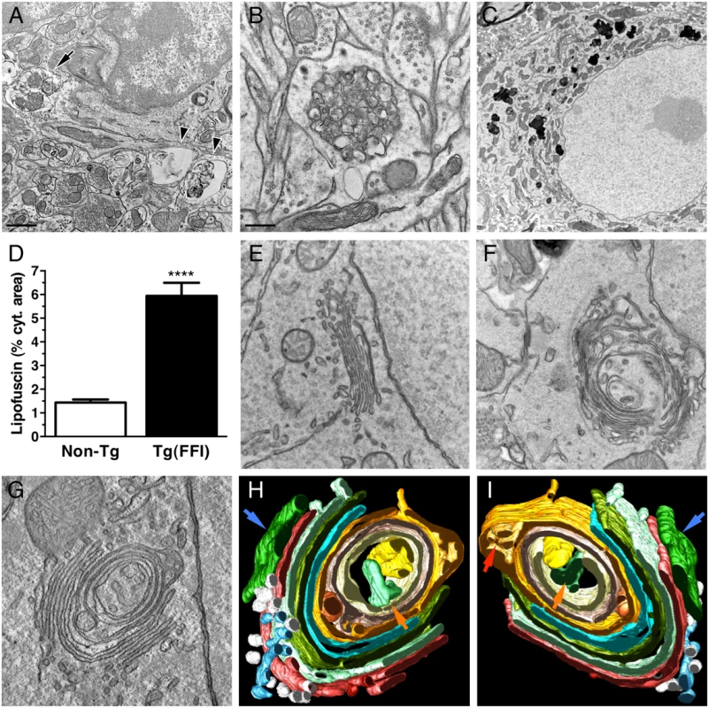 Ultrastructural abnormalities in Tg(FFI) neurons.