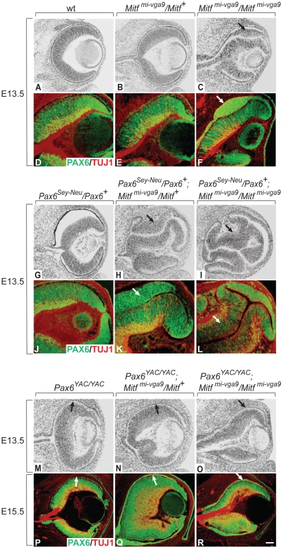 Gene dose of <i>Pax6</i> regulates dorsal RPE development in an <i>Mitf</i> mutant–lacking MITF protein.