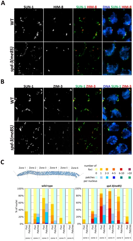 Localization of PC proteins to the NE in <i>spd-3(me85)</i> mutants.