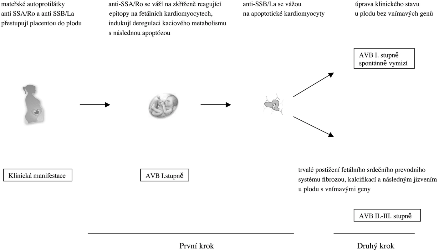 Dvoustupňový model patogeneze vzniku autoprotilátkami mediovaného vrozeného srdečního bloku. Mateřské autoprotilátky anti-SSA/Ro a anti-SSB/Lo přestupují placentou v průběhu těhotenství. V prvním kroku se Ro52 vážou na fetální kardiomyocyty, což způsobí deregulaci kalciového metabolismu a jejich následnou apoptózu. Autoprotilátky anti SSB/La se poté mohou navázat na apoptické buňky. U plodu nesoucích vnímavé geny (např. polymorfismus pro TGF‚) vedou depozita autoprotilátek ve druhém kroku k zánětlivé reakci s postupnou fibrotizací, kalcifikací a následnému jizvení převodního systému a klinickou manifestací je poté progrese AVB I. stupně do II. či do irreverzibilního III. stupně. U plodů bez vnímavých genů či geneticky vybavených rezistentními geny se nevytvoří trvalé postižení a AVB I. stupně spontánně regreduje a klinický stav se upraví.