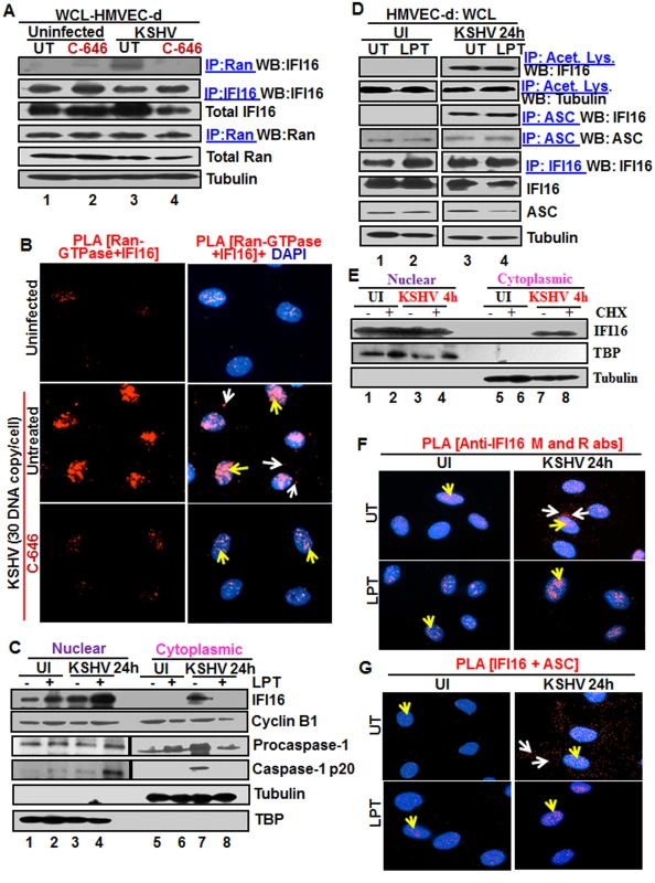 Effect of p300 inhibitor C-646 on IFI16 and Ran-GTPase association and effect of nuclear export blockage by Leptomycin B and protein synthesis inhibitor cycloheximide on the redistribution of IFI16 during <i>de novo</i> KSHV infection of HMVEC-d cells.