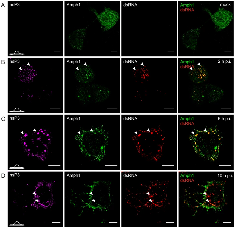 Dynamic changes in amphiphysin-1 localization during SFV infection of neuronal cells.