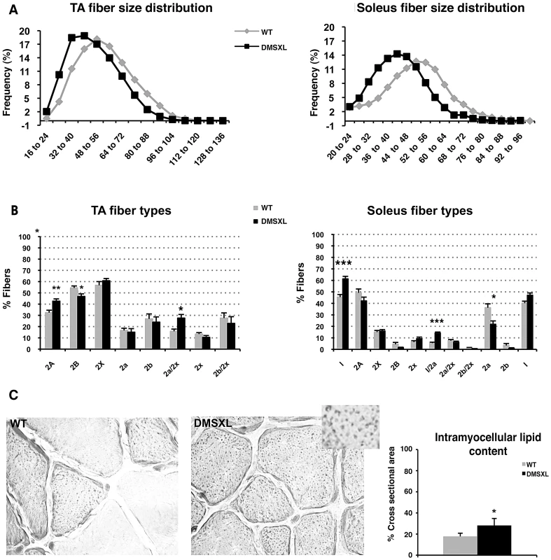 Histological abnormalities in DMSXL muscles.