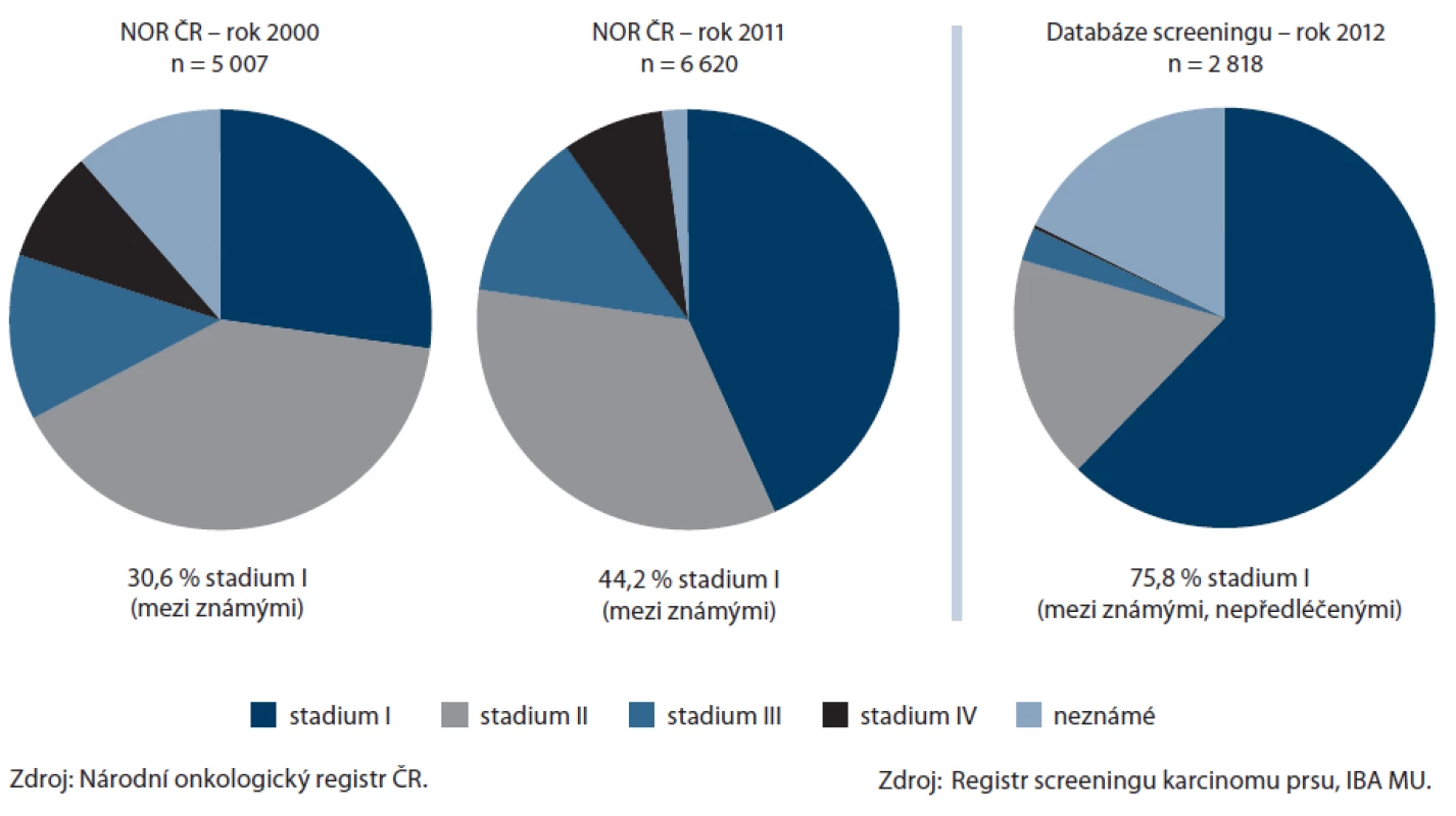 Srovnání populačního zastoupení klinických stadií ZN prsu (jen invazivní) v různých obdobích (vlevo) a zastoupení klinických stadií u ZN detekovaných ve screeningu (vpravo).