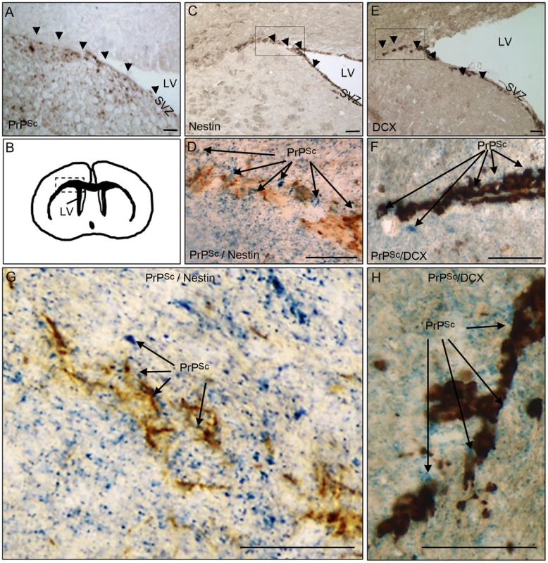 PrP<sup>Sc</sup> is present in NSC and neuroblasts areas.