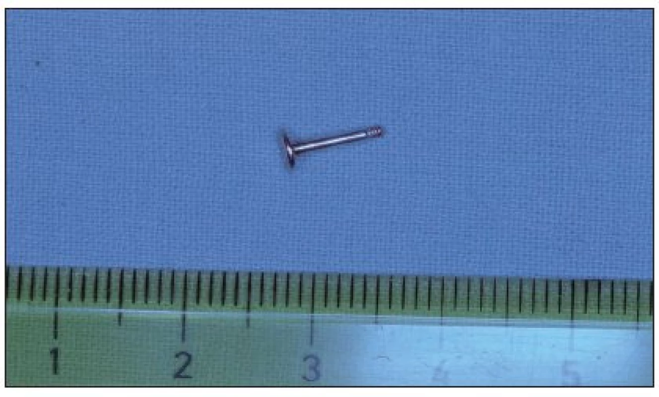 Vybavený piercing – labret.