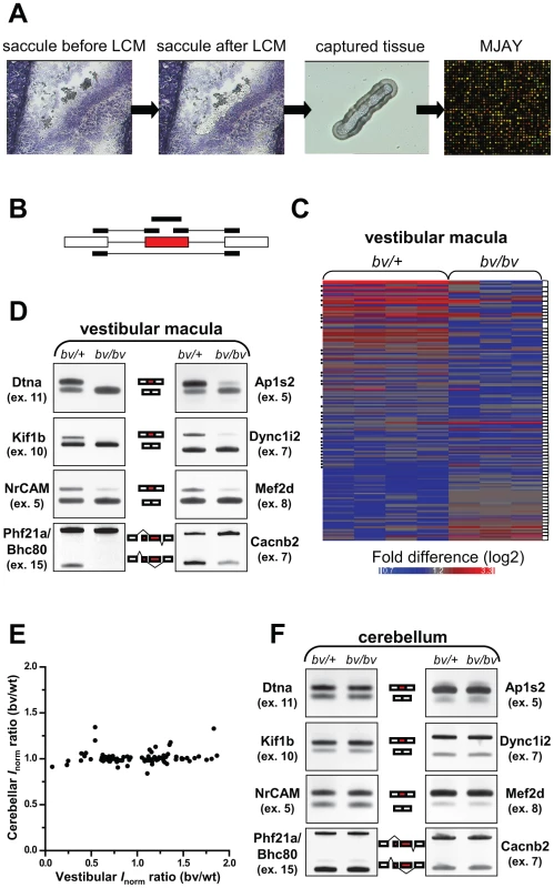 <i>bv/bv</i> mice are subject to splicing defects in the inner ear but not in the cerebellum.