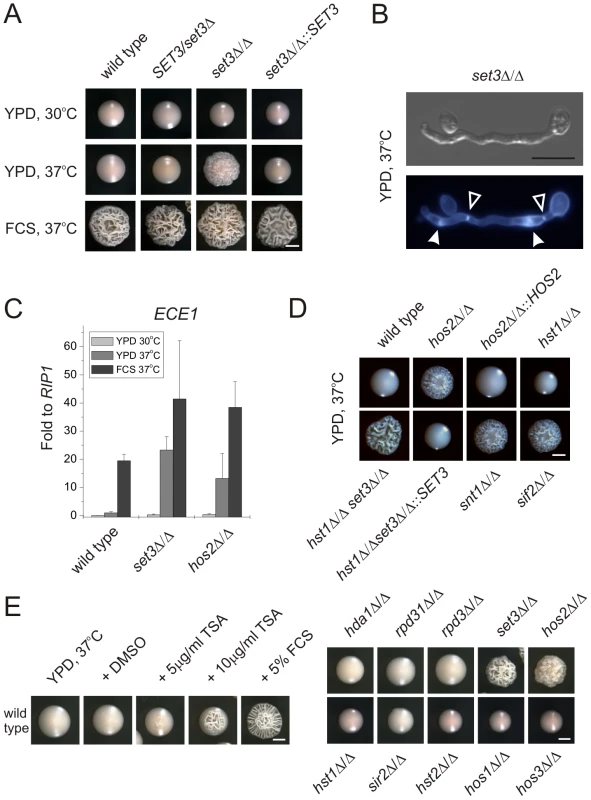 Loss of <i>SET3</i> promotes filamentation in <i>C. albicans</i>.