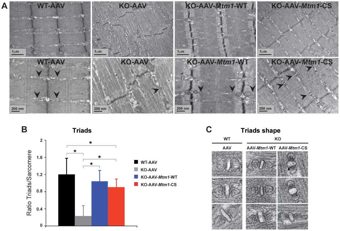 Improvement of triad abnormalities present in <i>Mtm1</i>-deficient muscles with AAV-<i>Mtm1</i>-WT and AAV-<i>Mtm1</i>-CS.