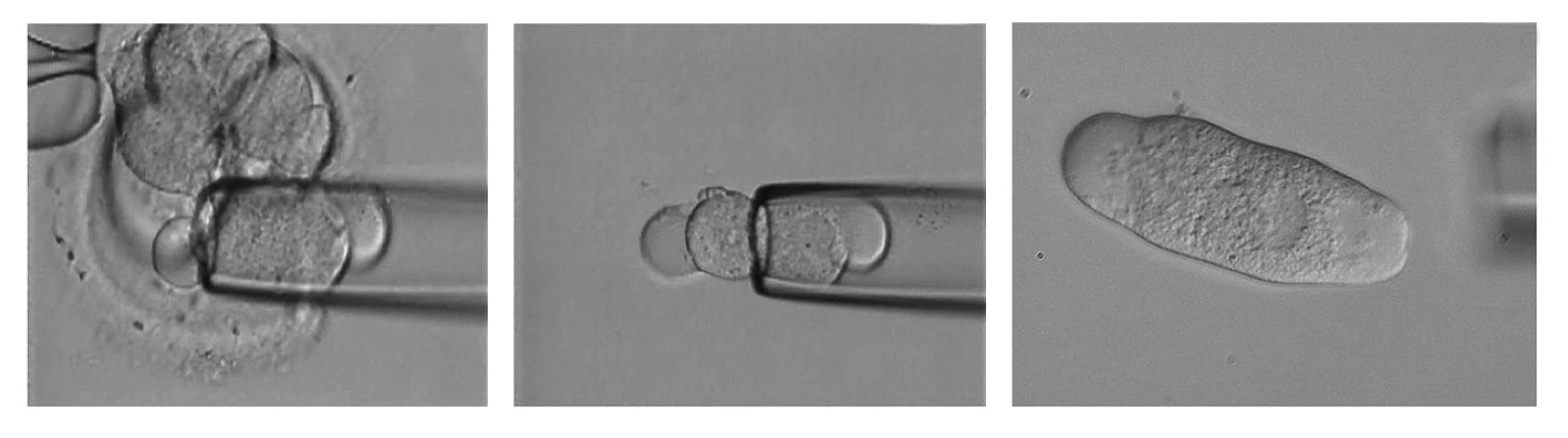 <i>Odběr blastomey z časného embrya.</i> A – nasávání 1 blastomey uvnitř embrya do bioptické pipety, B – uvolnění blastomey z bioptické pipety do média, C – odebraná blastomea určená pro PCR PGD s patrným buněčným jádrem.