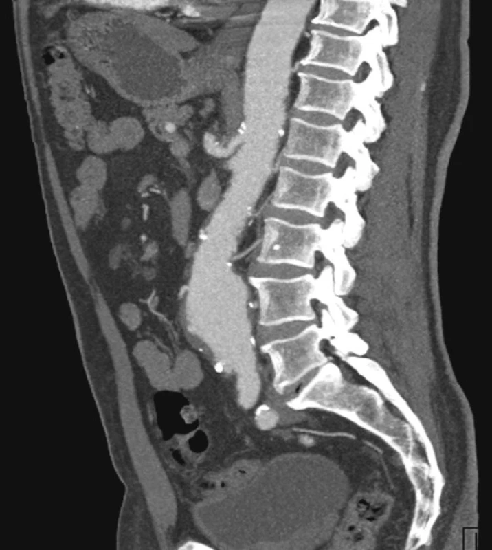 CTA obraz AAA
Fig. 2. CTA view of the AAA