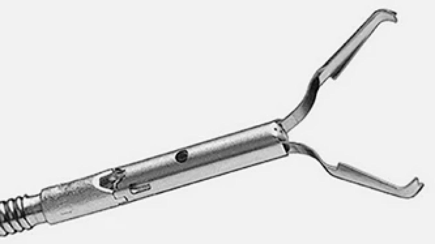 Klip TTSC (Boston Scientific Inc, Natick, USA).