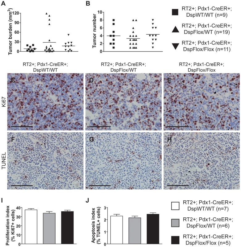 Genetic deletion of <i>desmoplakin</i> does not affect tumor growth parameters in <i>RT2</i> PNETs.