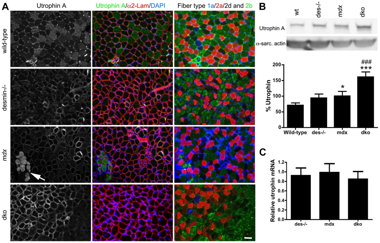 Expression and localization of utrophin in wild-type, desmin<sup>−/−</sup>, <i>mdx<sup>4cv</sup></i> and dko muscles at 3 weeks of age.