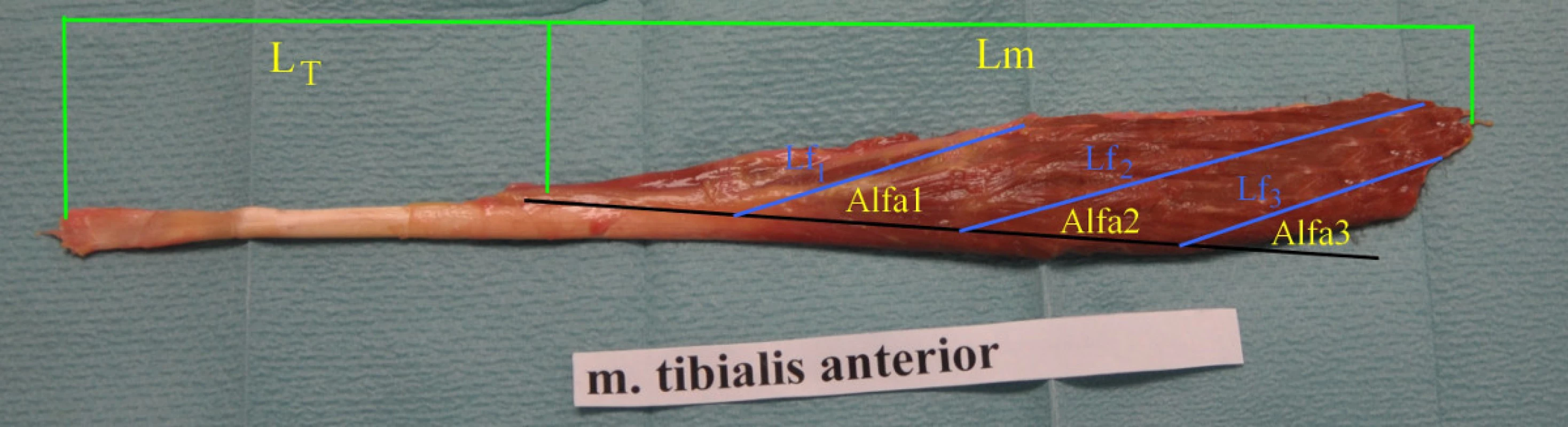 Preparát m. tibialis anterior, L<sub>T</sub>- délka mimosvalové části šlachy, L<sub>m</sub>- délka svalu, Lf<sub>1</sub>-Lf<sub>3</sub>- délka svalových vláken, Alfa 1 – Alfa 3- pennation úhel